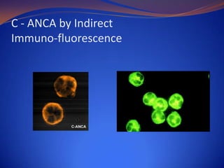 C - ANCA by Indirect
Immuno-fluorescence

 