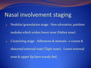 Nasal involvement staging
3. Nodular/granulation stage: Non-ulcerative, painless

nodules which widen lower nose (Hebra nose)
4. Cicatrizing stage: Adhesions & stenosis

coarse &

distorted external nose (Tapir nose). Lower external

nose & upper lip have woody feel.

 
