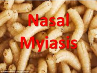 Nasal
Myiasis
 