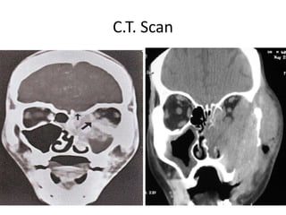 C.T. Scan
 