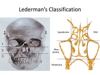 Lederman’s Classification
 