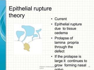 Epithelial rupture
theory • Current
• Epithelial rupture
due to tissue
oedema
• Prolapse of
lamina propria
through the
defect
• If the prolapse is
large it continues to
grow forming nasaldrtbalu's otolaryngology
online
30
 