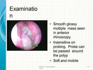 Examinatio
n
• Smooth glossy
multiple mass seen
in anterior
rhinoscopy
• Insensitive on
probing. Probe can
be passed around
the polyp
• Soft and mobile
drtbalu's otolaryngology
online
43
 