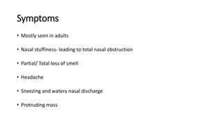 Symptoms
• Mostly seen in adults
• Nasal stuffiness- leading to total nasal obstruction
• Partial/ Total loss of smell
• Headache
• Sneezing and watery nasal discharge
• Protruding mass
 