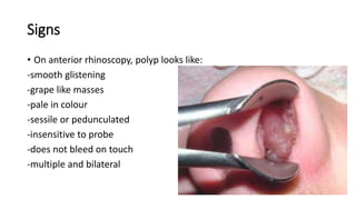 Signs
• On anterior rhinoscopy, polyp looks like:
-smooth glistening
-grape like masses
-pale in colour
-sessile or pedunculated
-insensitive to probe
-does not bleed on touch
-multiple and bilateral
 