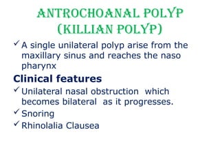 Defiant Polyp Nasal.............. polyp by Definet.pptx