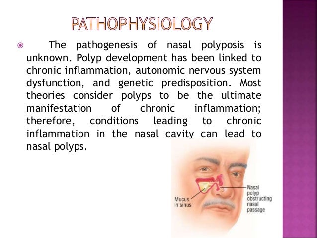 Nasal polyposis