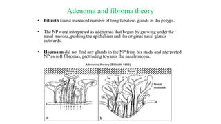 Adenoma and fibroma theory
• Billroth found increased number of long tubulous glands in the polyps.
• The NP were interpreted as adenomas that began by growing underthe
nasal mucosa, pushing the epithelium and the original nasal glands
outwards.
• Hopmann did not find any glands in the NP from his study andinterpreted
NP as soft fibromas, protruding towards the nasalmucosa.
 