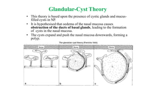 Glandular-Cyst Theory
• This theory is based upon the presence of cystic glands and mucus-
filled cysts in NP.
• It is hypothesised that oedema of the nasal mucosa causes
obstruction of the ducts of basal glands, leading to the formation
of cysts in the nasal mucosa.
• The cysts expand and push the nasal mucosa downwards, forming a
polyp.
 