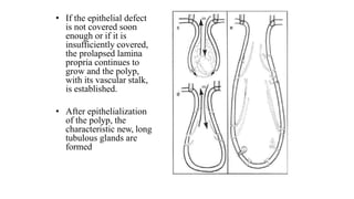 • If the epithelial defect
is not covered soon
enough or if it is
insufficiently covered,
the prolapsed lamina
propria continues to
grow and the polyp,
with its vascular stalk,
is established.
• After epithelialization
of the polyp, the
characteristic new, long
tubulous glands are
formed
 