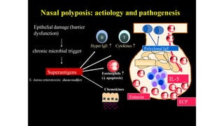 Nasal polyposis: aetiology and pathogenesis
Chemokines
T
Cytokines
B
Hyper IgE
Eosinophils
( apoptosis)
Superantigens
IL-5
ECP
Albumin
Eotaxin
Polyclonal IgE
Epithelial damage (barrier
dysfunction)
chronic microbial trigger
S. Aureusenterotoxins: diseasemodifiers
 