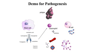 Demo for Pathogenesis
polyps
eosinophil
B cellMast cell
Arachydonic acid
5 lipoxygenase
Leukotrienes
Prostaglandin
Histamine
Interleukin
Cycloxygenase
cytokines
 
