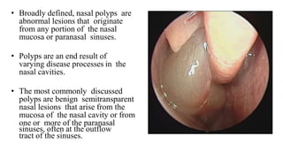 • Broadly defined, nasal polyps are
abnormal lesions that originate
from any portion of the nasal
mucosa or paranasal sinuses.
• Polyps are an end result of
varying disease processes in the
nasal cavities.
• The most commonly discussed
polyps are benign semitransparent
nasal lesions that arise from the
mucosa of the nasal cavity or from
one or more of the paranasal
sinuses, often at the outflow
tract of the sinuses.
 