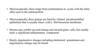 • Macroscopically, these range from erythematous to cystic with the latter
often seen in the antral portion.
• Microscopically, these polyps are lined by ciliated pseudostratified
epithelium that is usually intact, with a thin basement membrane.
• Stroma may exhibit myxoid change and stromal giant cells, but usually
lacks a significant inflammatory component.
• Rarely, degenerative changes including cholesterol granulomas and
angiomatous change may be found.
 
