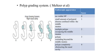 • Polyp grading system. ( Meltzer et al)
Endoscopic appearance
Score
no visible NP 0
small amount of polypoid
disease confined within the
middle
meatus
1
multiple polyps
occupying the middle
meatus
2
polyps
extending beyond the
middle meatus
3
polyps completely
obstructing the nasal
cavity
4
 