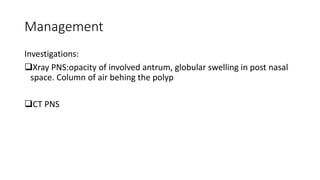 Management
Investigations:
Xray PNS:opacity of involved antrum, globular swelling in post nasal
space. Column of air behing the polyp
CT PNS
 
