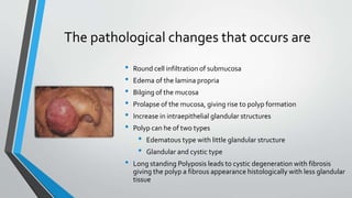 The pathological changes that occurs are
• Round cell infiltration of submucosa
• Edema of the lamina propria
• Bilging of the mucosa
• Prolapse of the mucosa, giving rise to polyp formation
• Increase in intraepithelial glandular structures
• Polyp can he of two types
• Edematous type with little glandular structure
• Glandular and cystic type
• Long standing Polyposis leads to cystic degeneration with fibrosis
giving the polyp a fibrous appearance histologically with less glandular
tissue
 