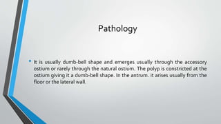 Pathology
• It is usually dumb-bell shape and emerges usually through the accessory
ostium or rarely through the natural ostium. The polyp is constricted at the
ostium giving it a dumb-bell shape. In the antrum. it arises usually from the
floor or the lateral wall.
 