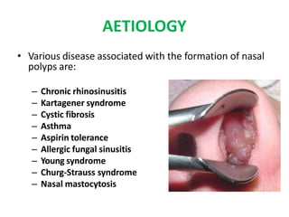 AETIOLOGY
• Various disease associated with the formation of nasal
polyps are:
– Chronic rhinosinusitis
– Kartagener syndrome
– Cystic fibrosis
– Asthma
– Aspirin tolerance
– Allergic fungal sinusitis
– Young syndrome
– Churg-Strauss syndrome
– Nasal mastocytosis
 