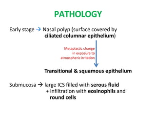 PATHOLOGY
Early stage  Nasal polyp (surface covered by
ciliated columnar epithelium)
Transitional & squamous epithelium
Submucosa  large ICS filled with serous fluid
+ infiltration with eosinophils and
round cells
Metaplastic change
in exposure to
atmospheric irritation
 