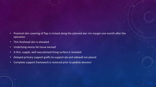 • Proximal skin covering of flap is incised along the planned alar rim margin one month after the
operation
• Thin forehead skin is elevated
• Underlying excess fat tissue excised
• A thin, supple, well vascularised lining surface is revealed
• Delayed primary support grafts to support ala and sidewall are placed
• Complete support framework is restored prior to pedicle devision
 