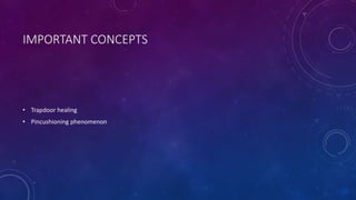 IMPORTANT CONCEPTS
• Trapdoor healing
• Pincushioning phenomenon
 