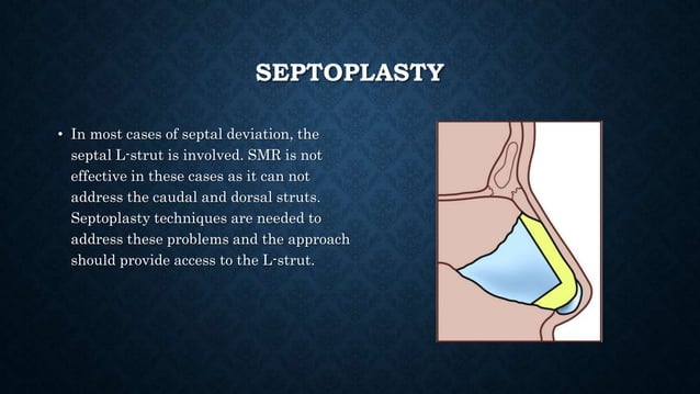 Nasal septal anatomy and septoplasty | PPTX | Ear, Nose and Throat ...