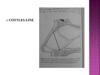 Nasal septum and its diseases[1] | PPT