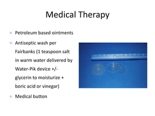 Medical Therapy
 Petroleum based ointments
 Antiseptic wash per
Fairbanks (1 teaspoon salt
in warm water delivered by
Water-Pik device +/-
glycerin to moisturize +
boric acid or vinegar)
 Medical button
 