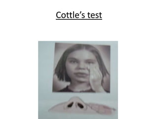 Cottle’s test
 