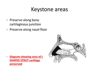 Keystone areas
 Preserve along bony
cartilaginous junction
 Preserve along nasal floor
 Diagram showing area of L
SHAPED STRUT cartilage
preserved
 