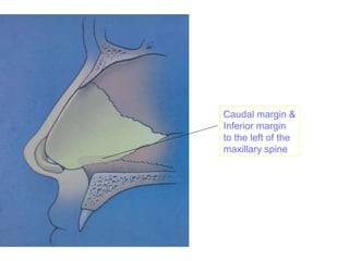 Caudal margin &
Inferior margin
to the left of the
maxillary spine
 