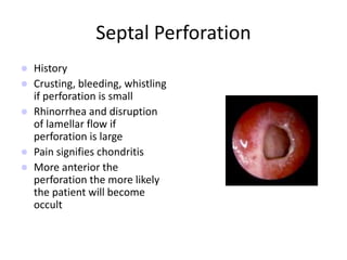 Septal Perforation
 History
 Crusting, bleeding, whistling
if perforation is small
 Rhinorrhea and disruption
of lamellar flow if
perforation is large
 Pain signifies chondritis
 More anterior the
perforation the more likely
the patient will become
occult
 
