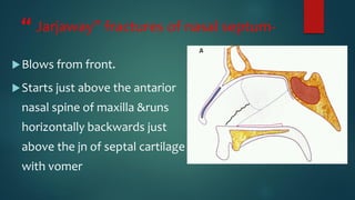 “ Jarjaway” fractures of nasal septum-
Blows from front.
Starts just above the antarior
nasal spine of maxilla &runs
horizontally backwards just
above the jn of septal cartilage
with vomer
 
