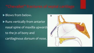 “Chevallet” fractures of septal cartilage
Blows from below.
Runs vertically from antarior
nasal spine of maxilla upwards
to the jn of bony and
cartilaginous dorsum of nose.
 