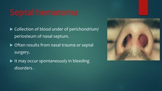 Septal hematoma
 Collection of blood under of perichondrium/
periosteum of nasal septum.
 Often results from nasal trauma or septal
surgery.
 It may occur spontaneously in bleeding
disorders .
 