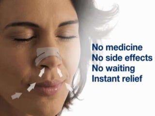 Nasal strips