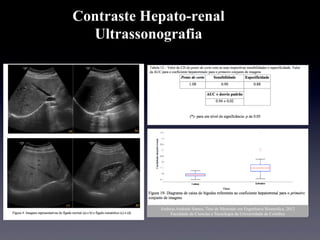 Contraste Hepato-renal
Ultrassonografia
Andreia Andrade Santos, Tese de Mestrado em Engenharia Biomedica, 2012
Faculdade de Ciencias e Tecnologia da Universidade de Coimbra
 