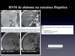 RNM de abdome na esteatose Hepática
November 2006 RadioGraphics, 26, 1637-1653.
 