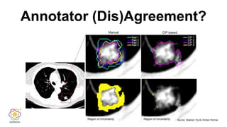 Annotator (Dis)Agreement?
Source: Stephen Yip & Chintan Parmar
 