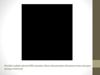 MonthlymultiplesclerosisMRIanimation.Showsdisseminationoflessionsintimeandspace
duringawholeyear
 