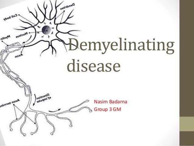 nasim badarna - demyelinating disease