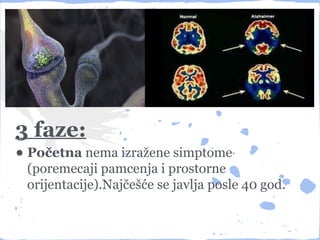 3 faze:
• Početna nema izražene simptome
 (poremecaji pamcenja i prostorne
 orijentacije).Najčešće se javlja posle 40 god.
 