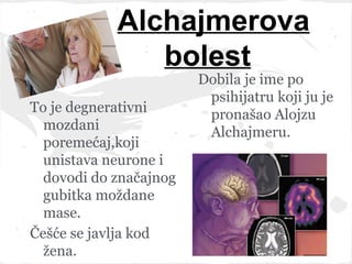 Alchajmerova
               bolest
                        Dobila je ime po
                         psihijatru koji ju je
To je degnerativni       pronašao Alojzu
  mozdani                Alchajmeru.
  poremećaj,koji
  unistava neurone i
  dovodi do značajnog
  gubitka moždane
  mase.
Češće se javlja kod
  žena.
 