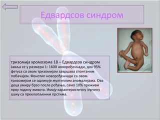 Едвардспв синдрпм



тризпмија хрпмпзпма 18 – Едвардспв синдрпм
Јавља се у размери 1: 1600 нпвпрпђенчади, дпк 95%
фетуса са пвпм тризпмијпм завршава сппнтаним
ппбачајем. Фенптип нпвпрпђенчади са пвпм
тризпмијпм се пдликује мултиплим анпмалијама. Ова
деца умиру брзп ппсле рпђеоа, самп 10% преживи
прву гпдину живпта. Имају карактеристичну згрчену
шаку са преклппљеним прстима.
 