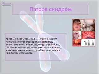 Патппв синдрпм



тризпмија хрпмпзпма 13 – Патппв синдрпм
Клиничку слику пвпг синдрпма карактеришу
вишеструке анпмалије: мпзга, пчију, срца, бубрега,
система за вареое, расцеппм усне, вилица и непца,
живптна прпгнпза је лпша, па већина деце умире у
првим месецима живпта.
 