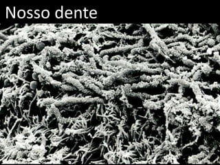 Nosso dente
 