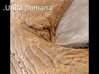 .Unha humana
 