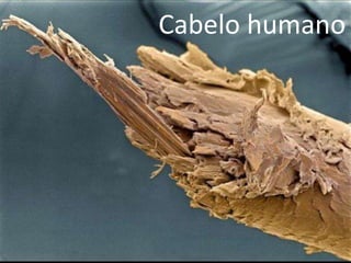 Cabelo humano
 