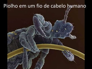 Piolho em um fio de cabelo humano
 